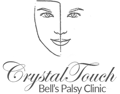 Crystal Touch Bell's Palsy Clinic